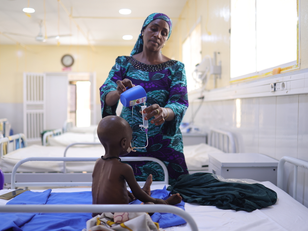 Pour le traitement du kwashiorkor, on commence par corriger l'hypoglycémie et l'hypothermie, et par assurer une prise en charge adéquate de l'hydratation en cas de choc. On passe ensuite à la phase d'alimentation : en débutant avec le lait thérapeutique F75, puis en effectuant la transition vers le lait thérapeutique F100 une fois que les œdèmes ont régressé. Katsina, Nigéria, juin 2026 ©Abba Adamu Musa/MSF