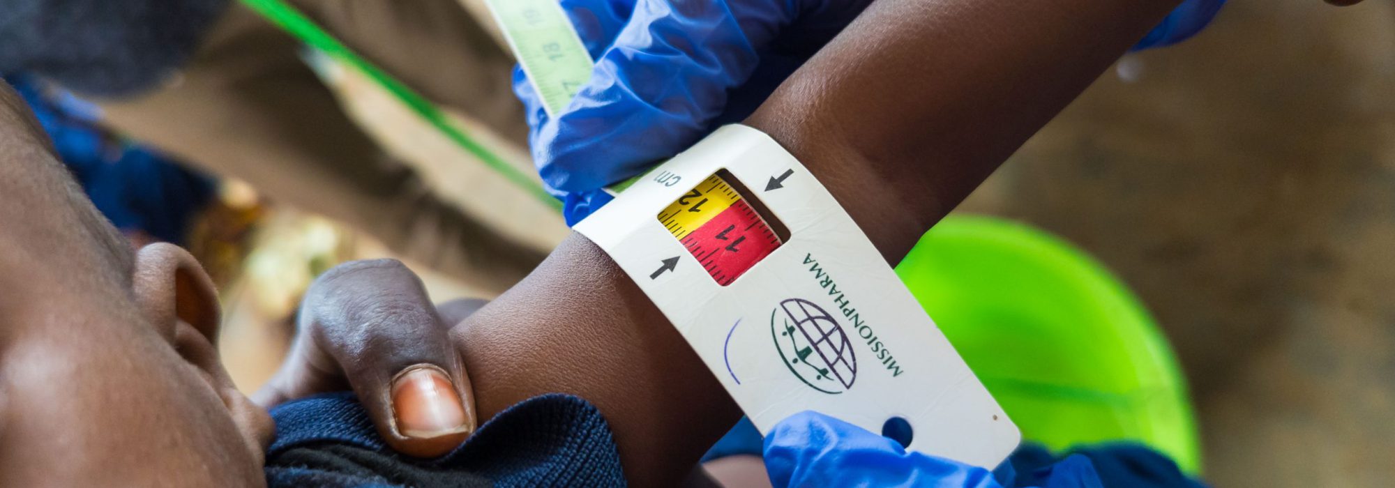 Une infirmière mesure le périmètre brachial d'un enfant dans un poste de santé soutenu par MSF à Bur-shabelow, sur un site de personnes déplacées internes (PDI) à Baidoa, en Somalie.